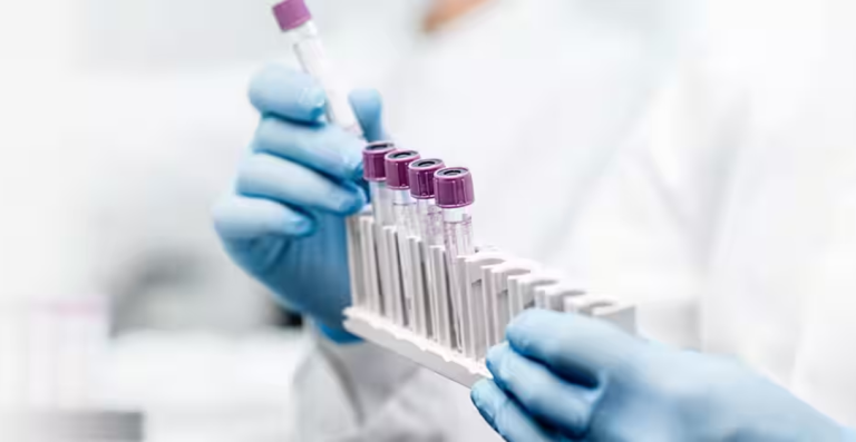 Healthcare professional holding blood sample test tubes in laboratory