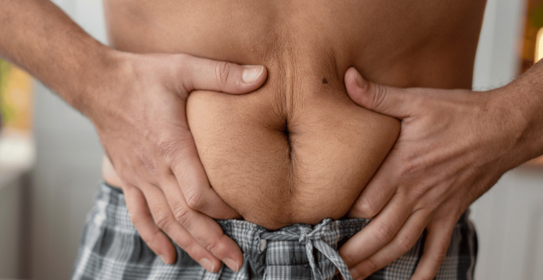 Man holding abdominal fat related to hormonal weight gain